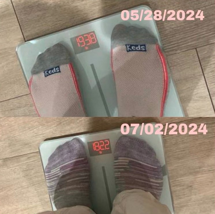 Before and after: Semaglutide