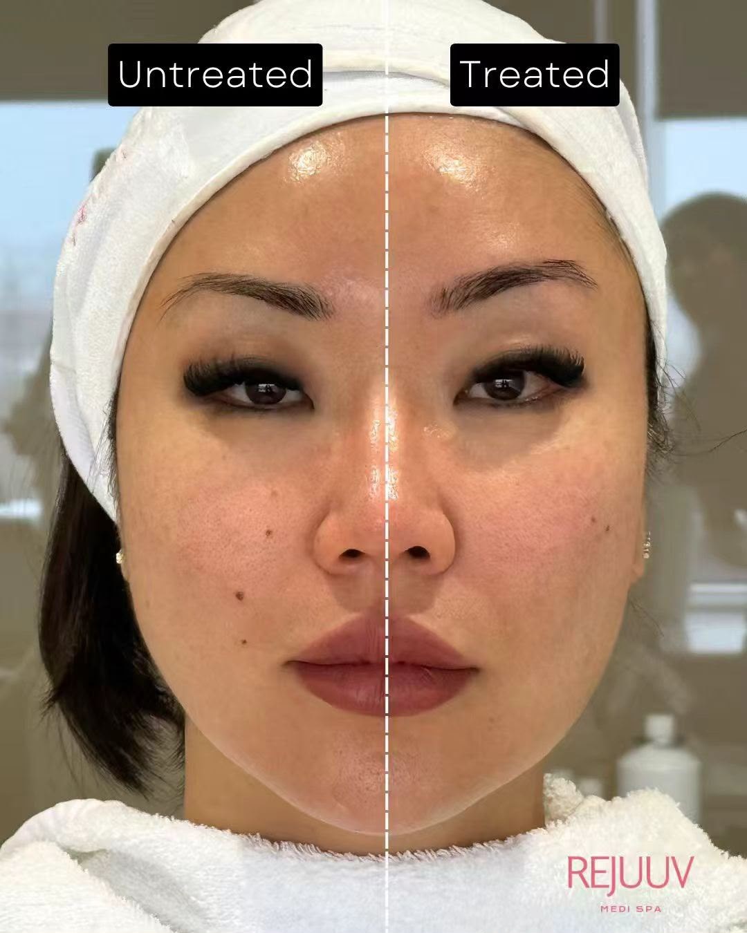 Before and after: Xerf
