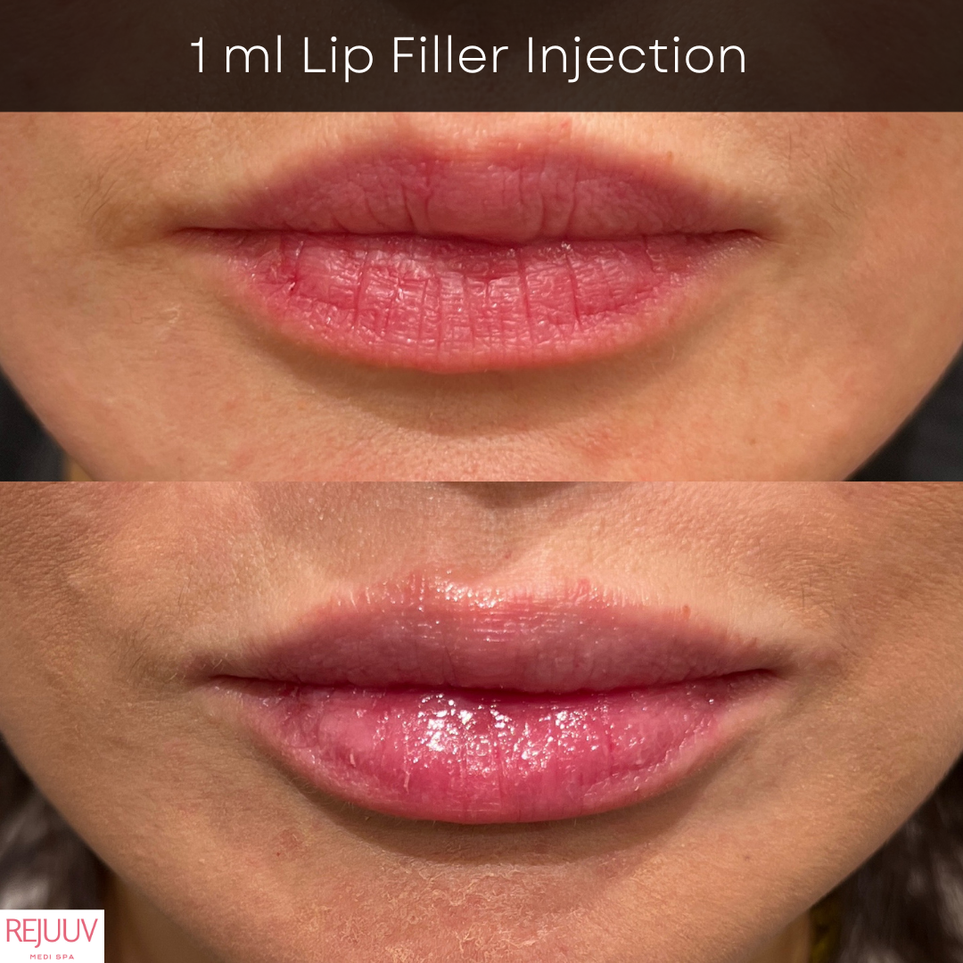 Before & after 3 - 2024-12-03T111623.313