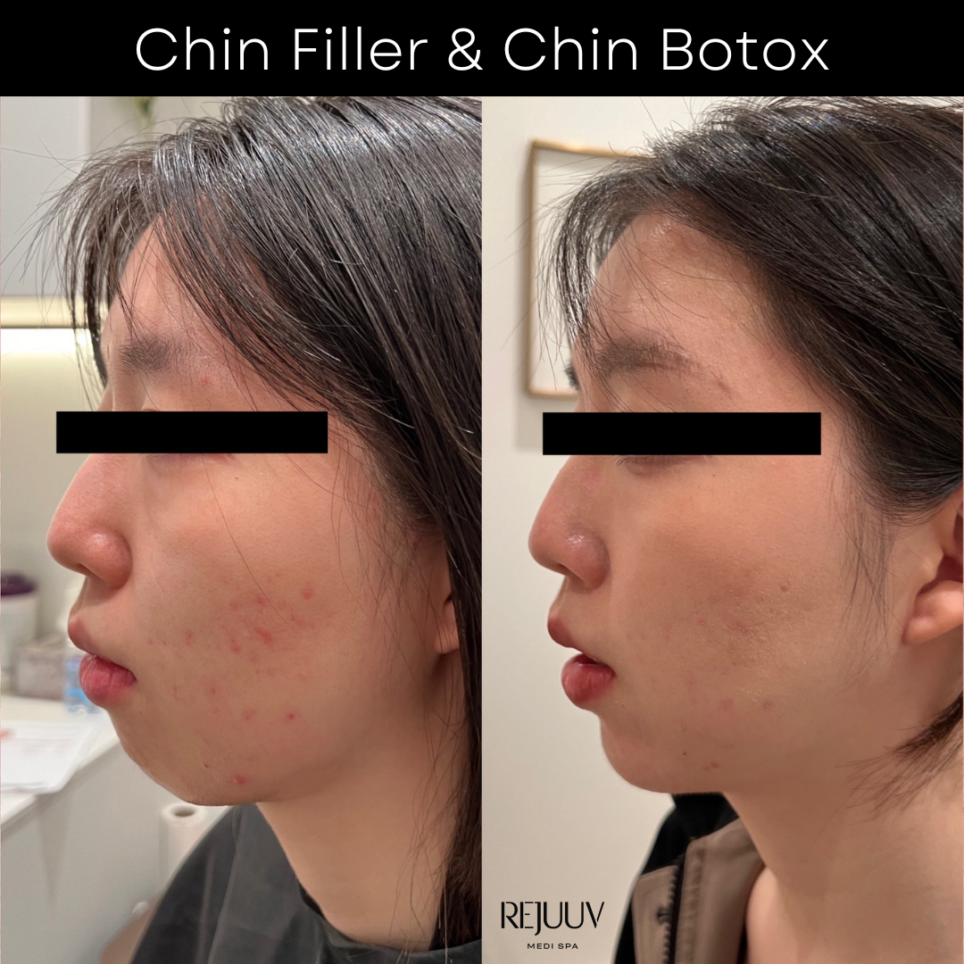 Before & after 3 (97)