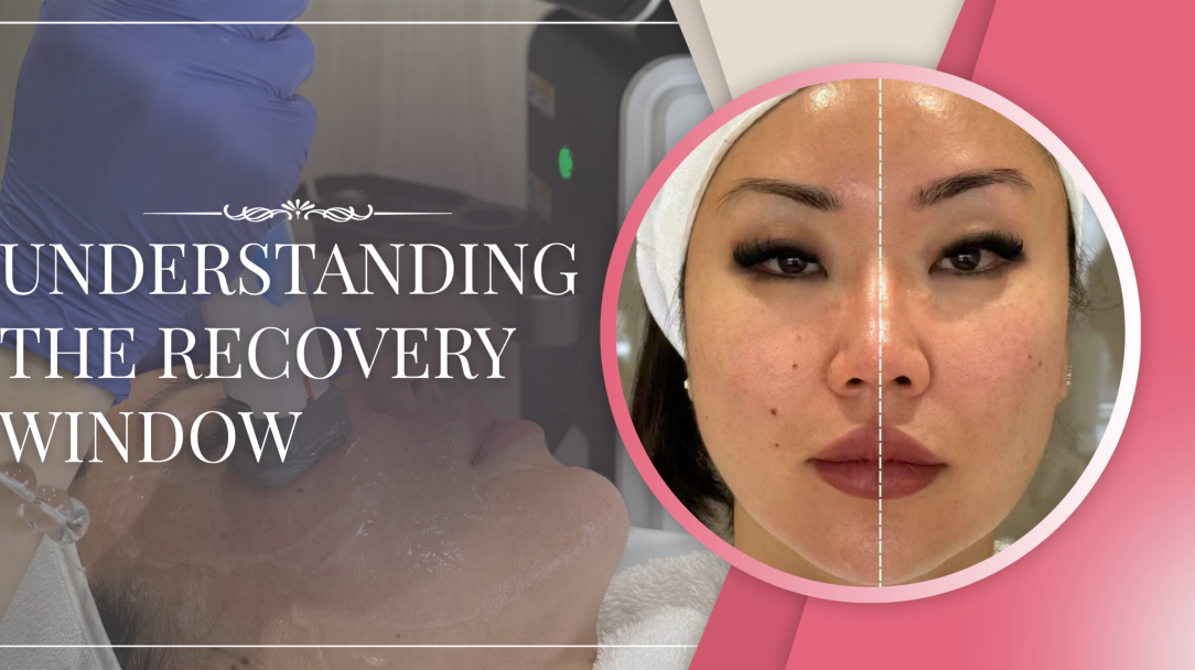 How Long Is Recovery After Non-Surgical Treatments