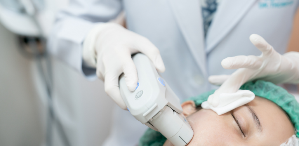 Ultherapy Treatment Performed by trained professional
