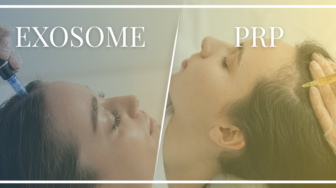 exosomes-vs-prp-which-skin-rejuvenation-treatment-is-right-for-you